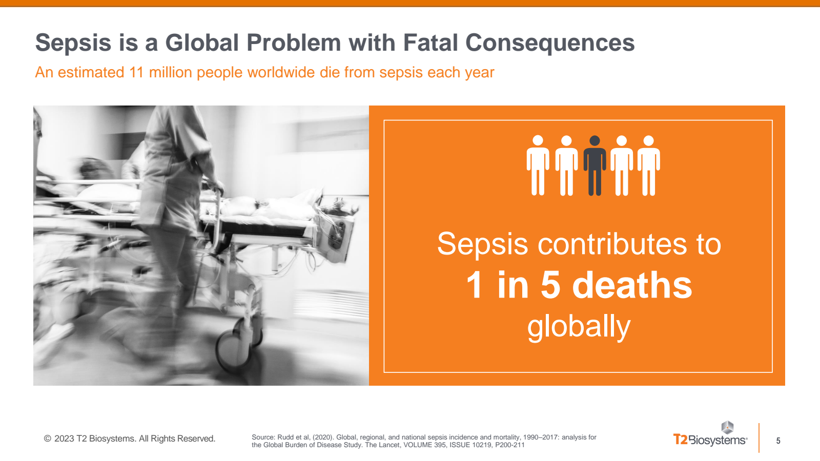Sepsis is a Global P